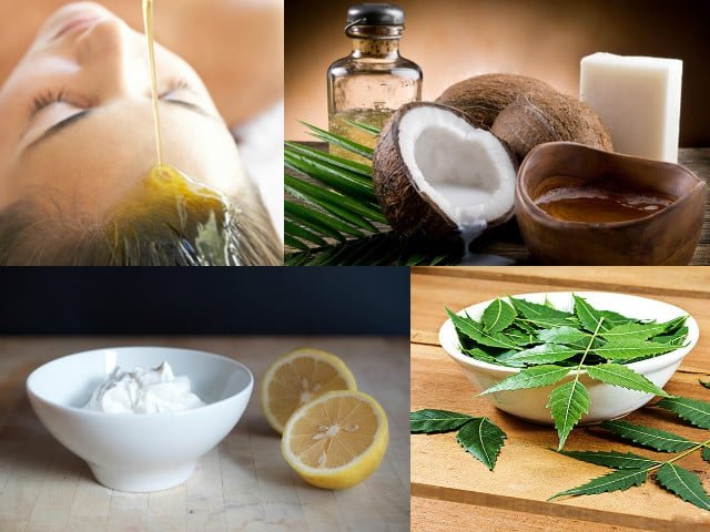 Dandruff Home Remedies : सिर में पपड़ी और डैंड्रफ का इलाज है ये 5 घरेलु नुस्खे, जड़ से खत्म होगी परेशानी