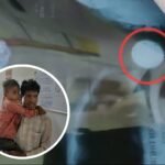 Betul News | Innocent child swallowed 2 rupee coin