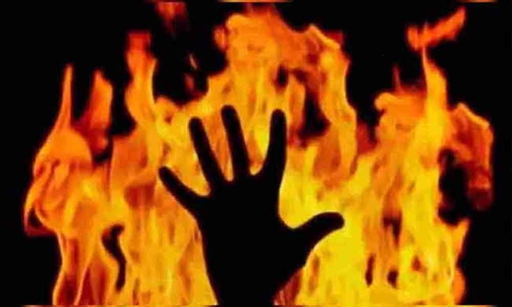 आग से झुलसी