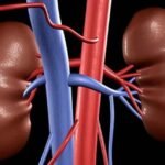 किडनी डिजीज के मामले भारत में