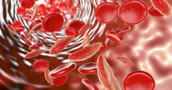 आरआरआई ने बनाया सिकल सेल