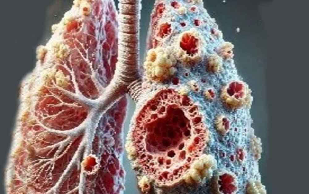 17 वर्षीय चीयरलीडर पॉपकॉर्न लंग्स