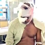 भालू के हमले से