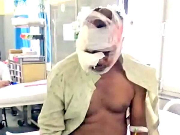 भालू के हमले से