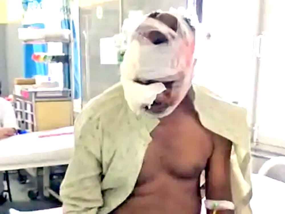 भालू के हमले से