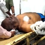 नागपुर में हो रहा करंट लगने से झुलसे