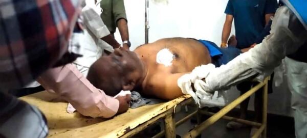 नागपुर में हो रहा करंट लगने से झुलसे