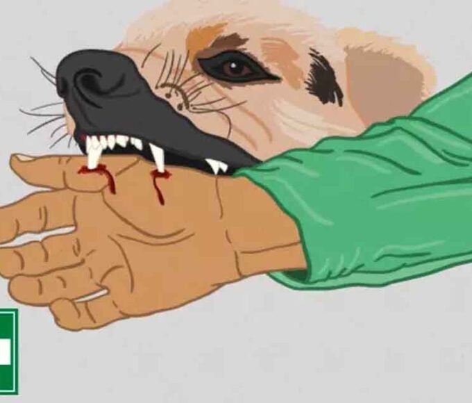 डॉग बाइट पीड़ितों को मिलेगा