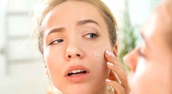 सर्दियों में ड्राई स्किन को मॉइश्चराइज्ड और