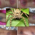 ‘हार्मलेस’ मानी जाने वाली मकड़ी भी
