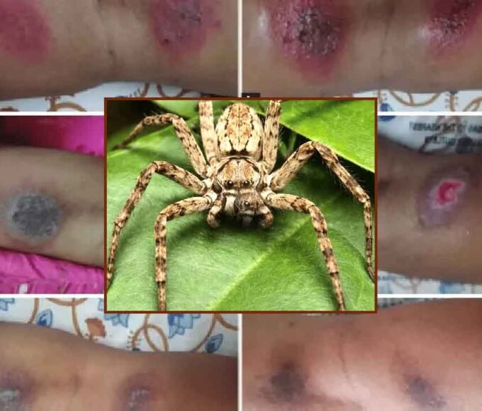 ‘हार्मलेस’ मानी जाने वाली मकड़ी भी
