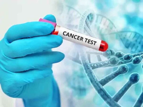 उज्जैन बनेगा कैंसर जांच और इलाज का